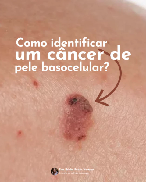 Publicação 2 da Dra. Ildalia Vertuan no Instagram